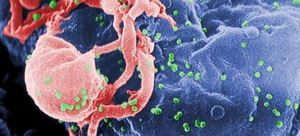 virus de la sida, VIH