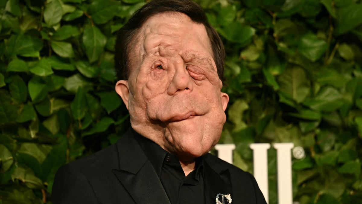 Adam Pearson, el actor con desfiguración facial que desafía las reglas de Hollywood: “El mundo está obsesionado con lo normal”